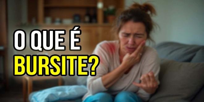 BURSITE: O QUE É E COMO TRATAR?