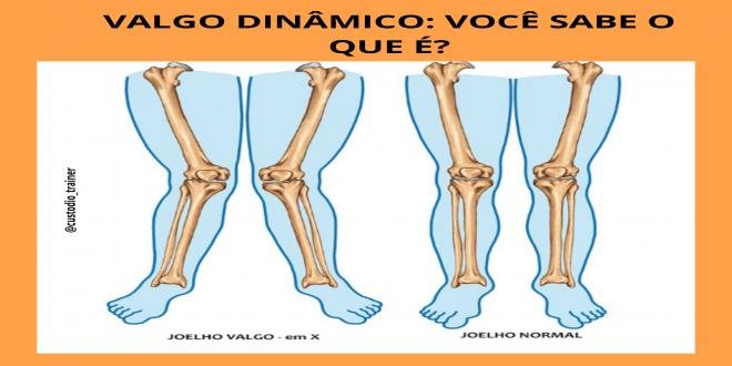 VALGO DINÂMICO: VOCÊ SABE O QUE É?